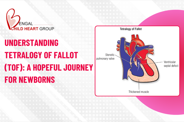 Understanding Tetralogy of Fallot (TOF): A Hopeful Journey for Newborns