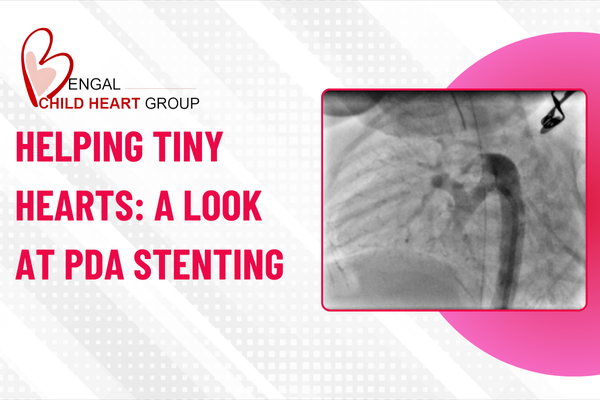 Helping Tiny Hearts: A Look at PDA Stenting